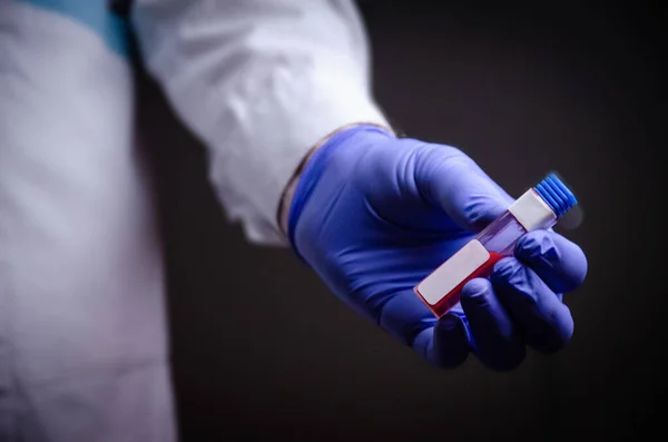 Doctor Holds Coronavirus His Hand Blood Test Inscription Covid Medical — Stock Photo, Image