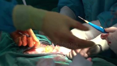 Ameliyat ekibi sezaryen ameliyatı operasyonu.