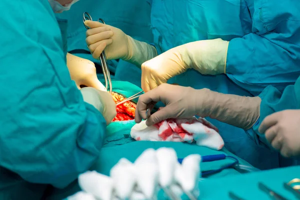Pacjentów poddawanych zespołu chirurgicznego w sali operacyjnej. — Zdjęcie stockowe