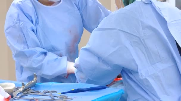 Equipo quirúrgico realizando operación quirúrgica . — Vídeo de stock