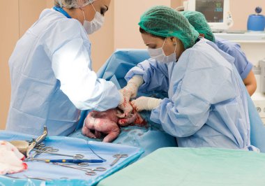 Ameliyat ekibi cerrahi işlemi gerçekleştirerek. Doktor performans s