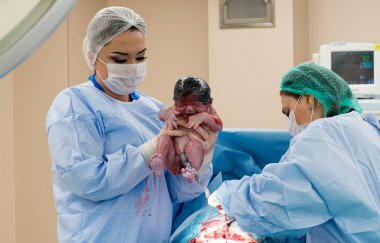 Ameliyat ekibi cerrahi işlemi gerçekleştirerek. Doktor performans s