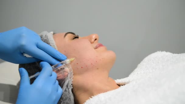 Mujer Joven Recibiendo Biorevitalización Del Procedimiento Facial Beautician Manos Guantes — Vídeos de Stock