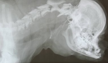 Röntgen film dog Head'a ve kafatası