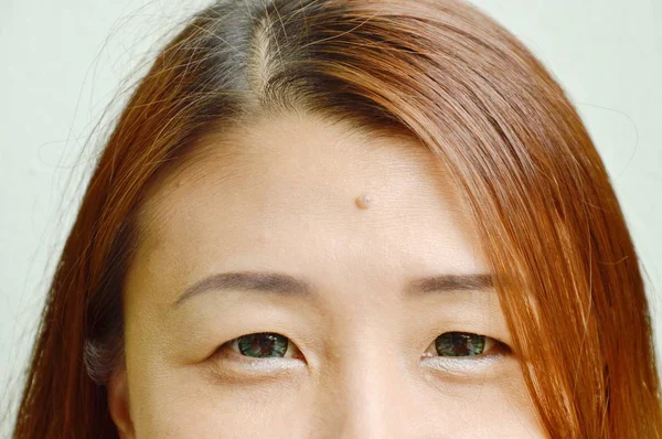鼹鼠在亚洲妇女额头中间显示出面貌 — 图库照片
