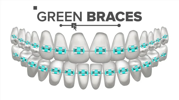 Criança Verde Braces Vector. Dente e aparelho dentário. Mandíbula Humana. Ilustração isolada realista 3D —  Vetores de Stock