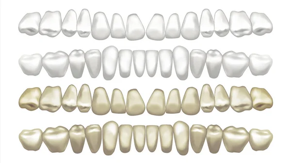 Dentes Whitening Vector. Antes e depois. Clareamento do folheado dental. Ilustração isolada —  Vetores de Stock