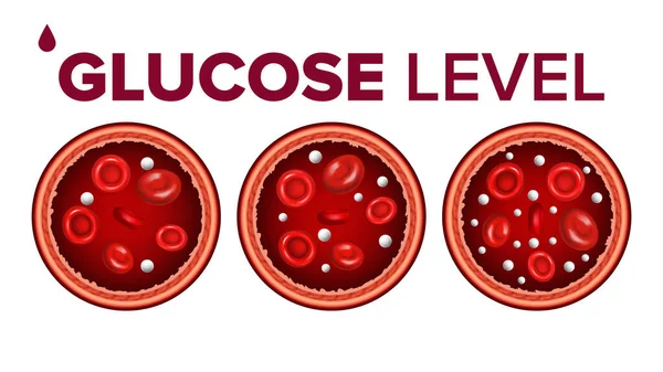 Glucosesuikergehalte in bloed en rode bloedcellen Vector — Stockvector