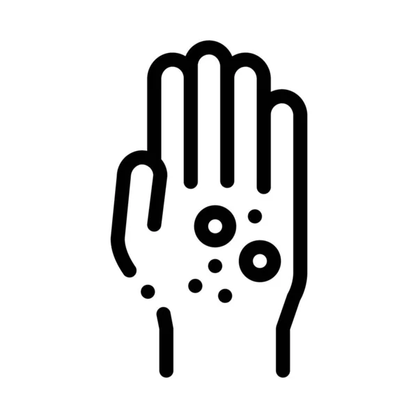 Dermatitis Hautausschlag an den Händen Symbol Vektor Umriss Illustration — Stockvektor