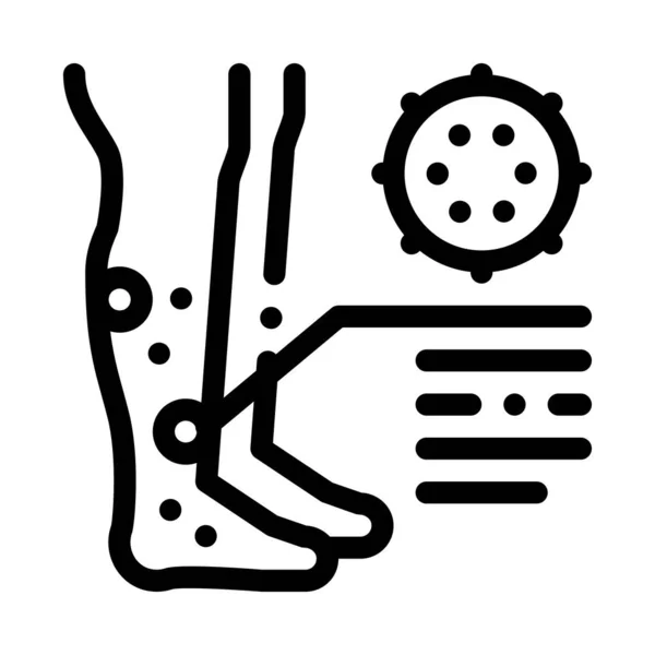 足の上の発疹皮膚炎アイコンベクトルアウトラインイラスト — ストックベクタ