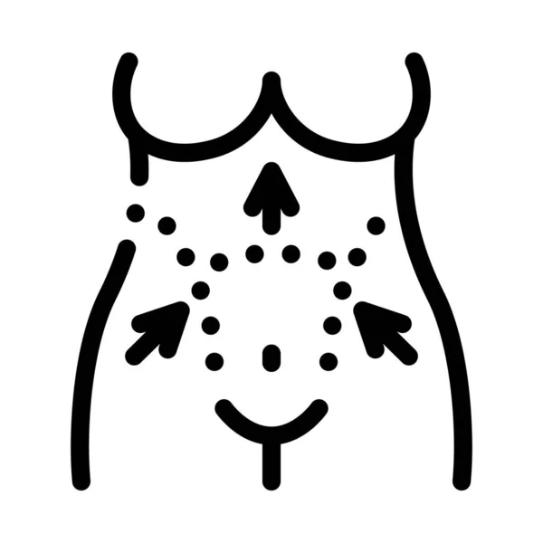 Abdominoplastia Vector Icono Signo Barriga Ilustración Símbolo Contorno Aislado — Archivo Imágenes Vectoriales