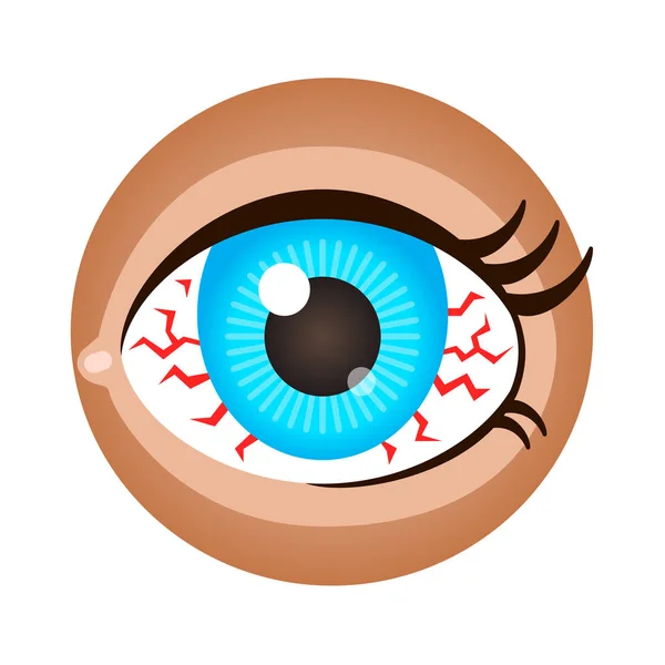 Red eye. Vector design elements. — Stock Vector