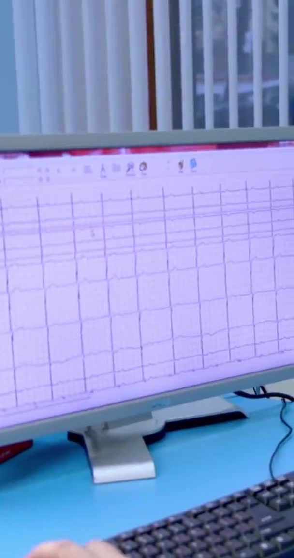 Medische hartmonitor strip. Hartmonitor afdrukken elektrocardiogram diagnostische resultaten. Close-up van de ecg-afdruk. — Stockvideo