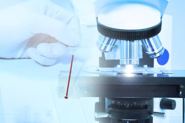 laboratuarda test kan ve kan laboratuvar mikroskop görüntüsünü kapatmak 