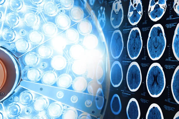 Bilder einer Computertomographie des Gehirns und Operationslampen im Operationssaal — Stockfoto