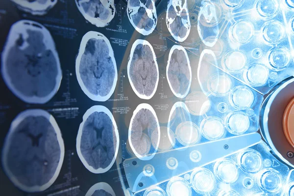 Imágenes de una tomografía computarizada del cerebro y lámparas quirúrgicas en el quirófano — Foto de Stock