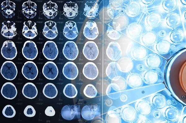 Imágenes de una tomografía computarizada del cerebro y lámparas quirúrgicas en el quirófano — Foto de Stock