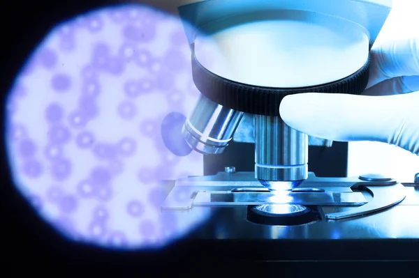 Close-up tiro de microscópio no laboratório de sangue e glóbulos vermelhos ao microscópio — Fotografia de Stock