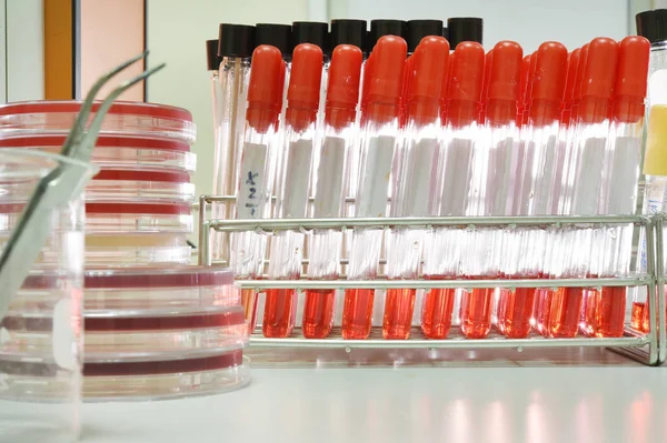 Esami del sangue in laboratorio — Foto Stock