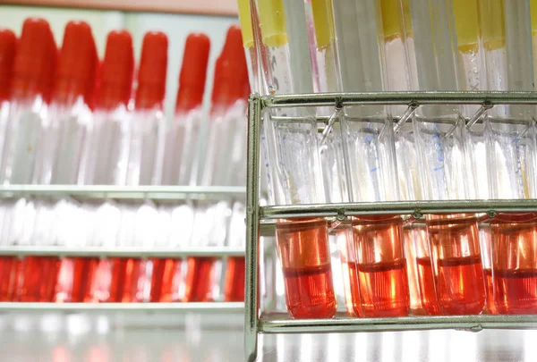 Blood testing in laboratory — Stock Photo, Image