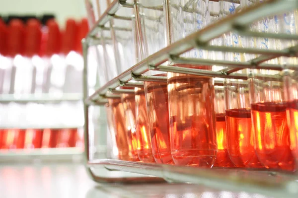 Blood testing in laboratory — Stock Photo, Image