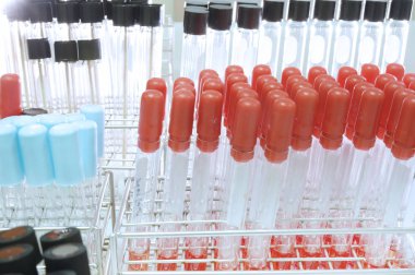 kan laboratuarda test 