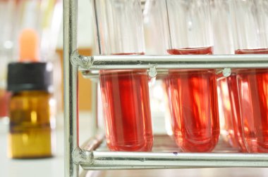 kan laboratuarda test 