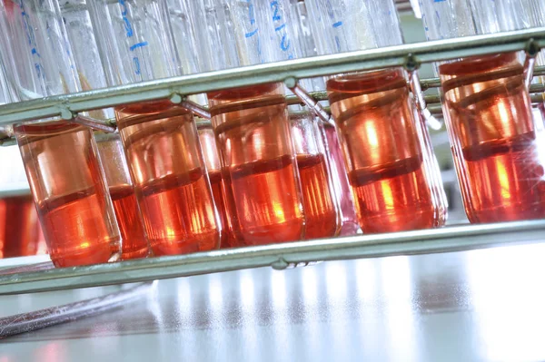 Blood testing in laboratory — Stock Photo, Image