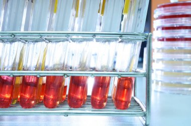 kan laboratuarda test 