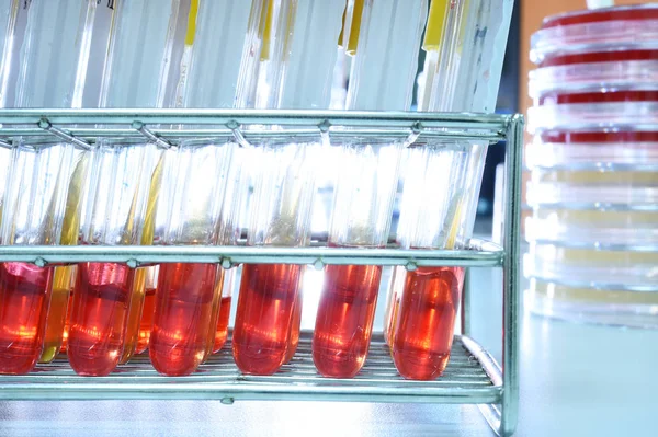 Blood testing in laboratory — Stock Photo, Image