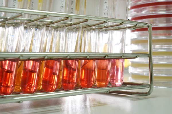 Análises ao sangue em laboratório — Fotografia de Stock