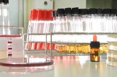 kan laboratuarda test 