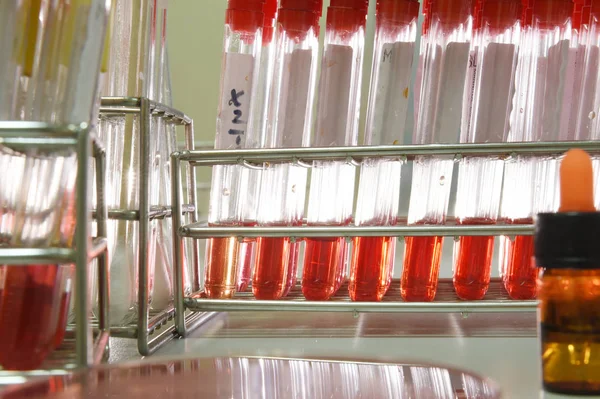 Vér laboratóriumi vizsgálata — Stock Fotó