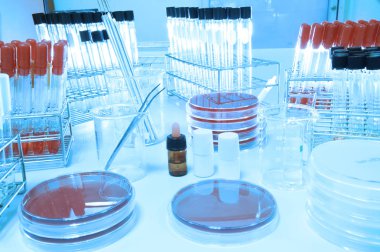 kan laboratuarda test 