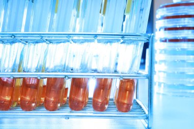 kan laboratuarda test 