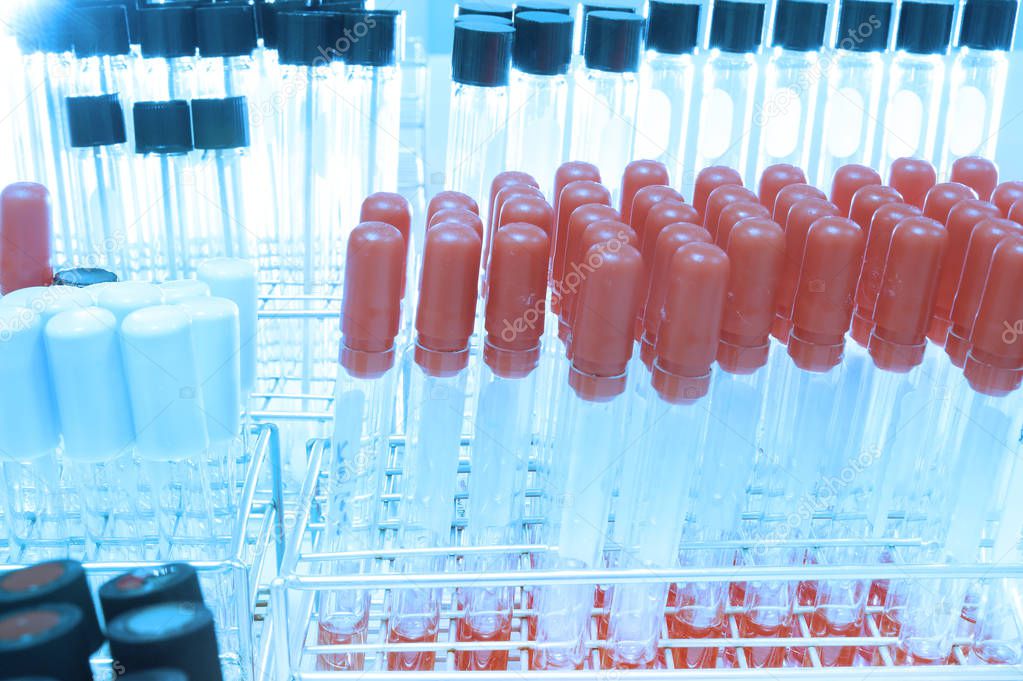 blood testing in laboratory 