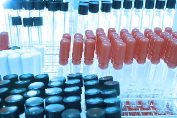 kan laboratuarda test 