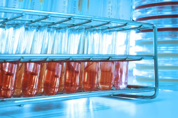 kan laboratuarda test 