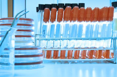 kan laboratuarda test 