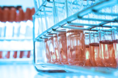 kan laboratuarda test 