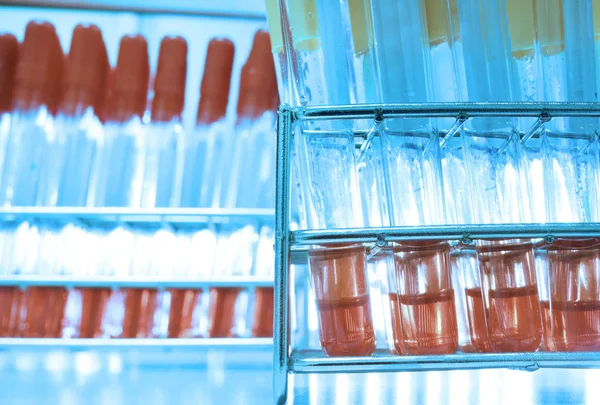 Blood testing in laboratory — Stock Photo, Image