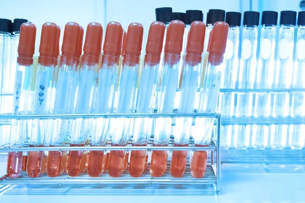 Análises ao sangue em laboratório — Fotografia de Stock