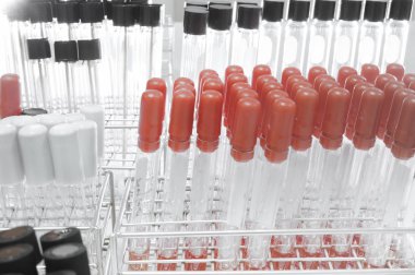 kan laboratuarda test 