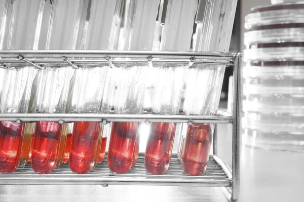 Esami del sangue in laboratorio — Foto Stock