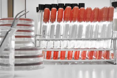 kan laboratuarda test 