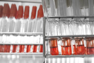 kan laboratuarda test 