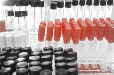 kan laboratuarda test 