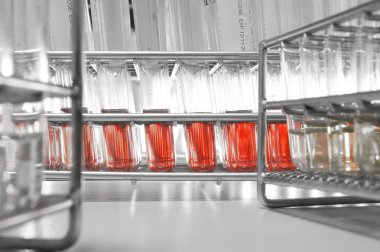 kan laboratuarda test 