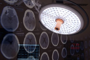 beyin ve cerrahi lambalar operasyon odasında bir bilgisayarlı tomografi görüntüleri