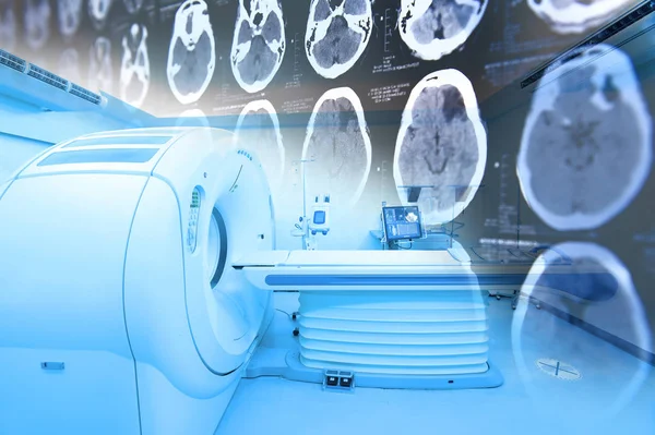 Mri Scanner Room Mit Bildern Aus Einer Computertomographie Des Gehirns — Stockfoto